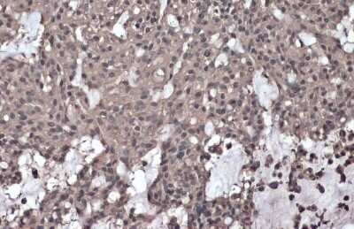 Immunohistochemistry-Paraffin: IKK gamma [p Ser376] Antibody [NBP3-13396]